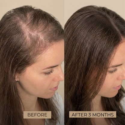 MAVI ELIXIR - Scalp & Hair Growth Oil