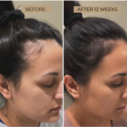 MAVI ELIXIR - Scalp & Hair Growth Oil