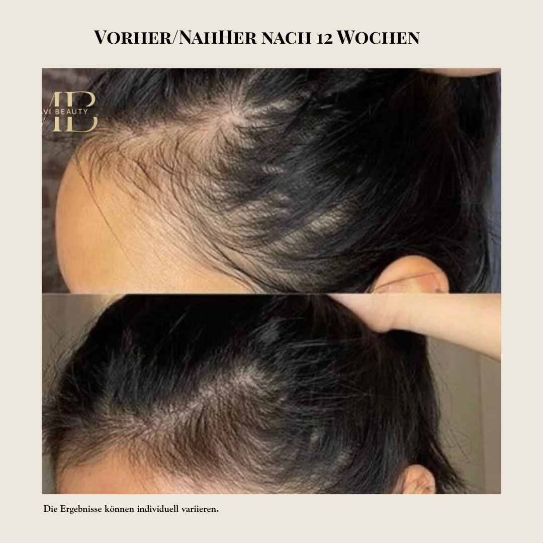 MAVI ELIXIR - Scalp Treatment Oil