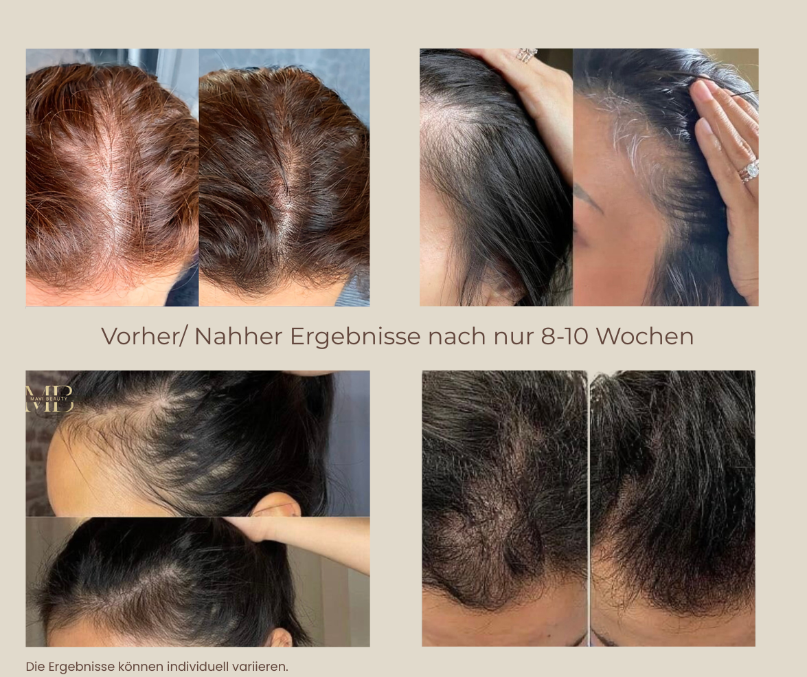 MAVI ELIXIR - Scalp Treatment Oil